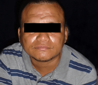 Detienen sujeto que atacó cámaras de video vigilancia en Cancún.