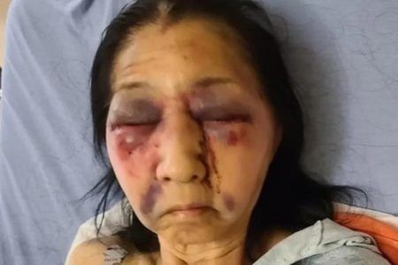 Golpean en Los Ángeles a adulta mayor mexicana; la confundieron con asiática
