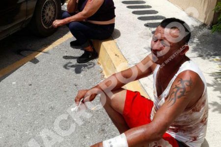 AMOR ASESINO.- Pareja resuelve sus problemas a martillazos y un baño de ácido muriático