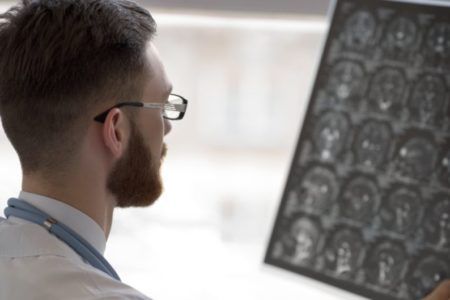 Los cerebros de hombres y mujeres se organizan de forma diferente, señala estudio realizado con inteligencia artificial