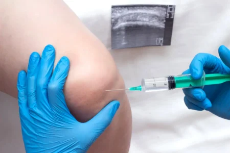 Nuevo biomaterial revoluciona la reparación del cartílago de forma poco invasiva